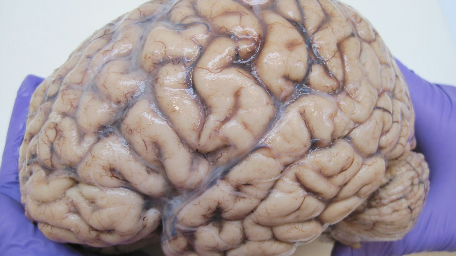 Mind-Blowing Facts about the Human Brain